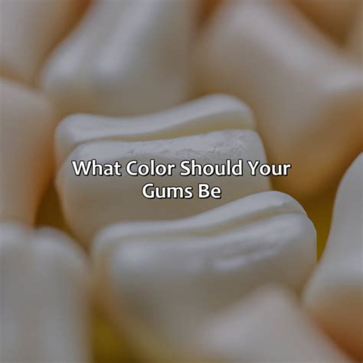 What color should my gum graft be?