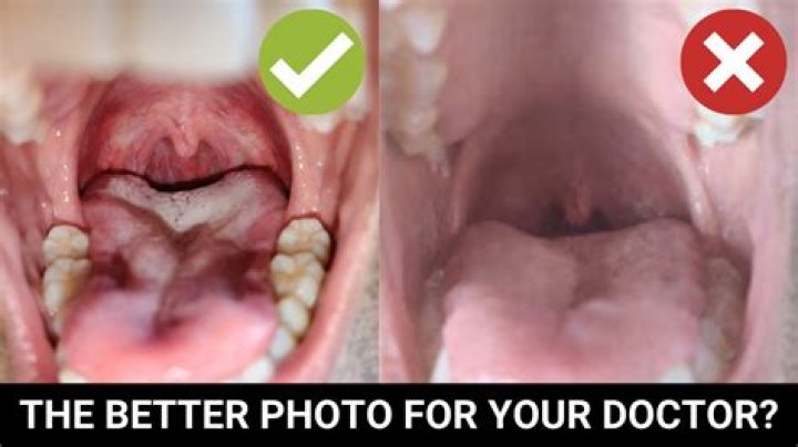 What do doctors look for when you open your mouth?