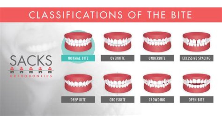 What does bite your arm off mean?