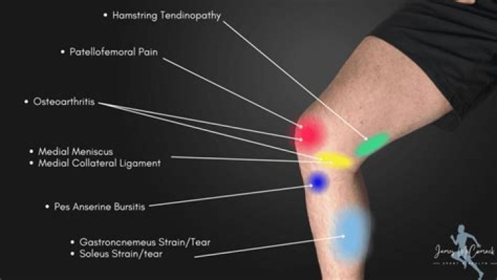 What does it mean if your knee feels weird?