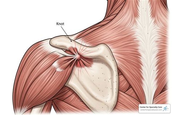 What does knot release feel like?