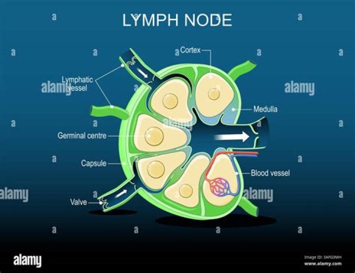 What does Level 2 lymph nodes mean?