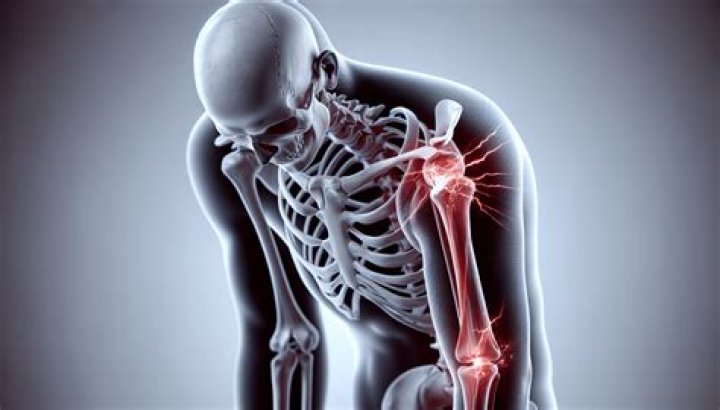 What does osteoporosis pain feel like?