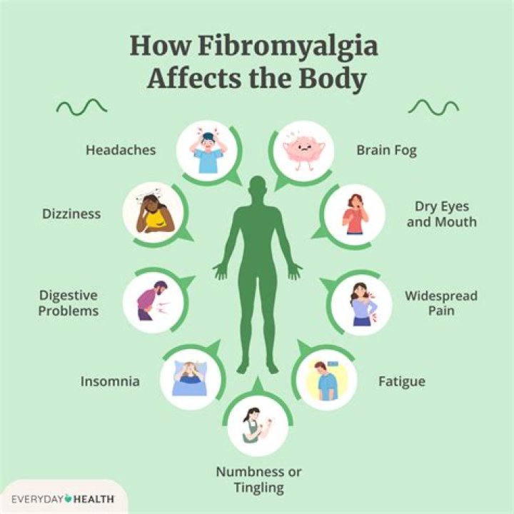 What does the start of fibromyalgia feel like?
