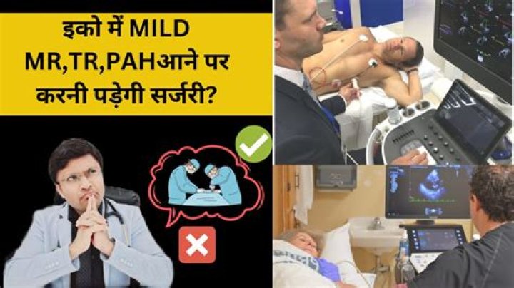 What does TR mean McDonalds?