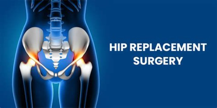 What happens after 3 months of hip replacement?