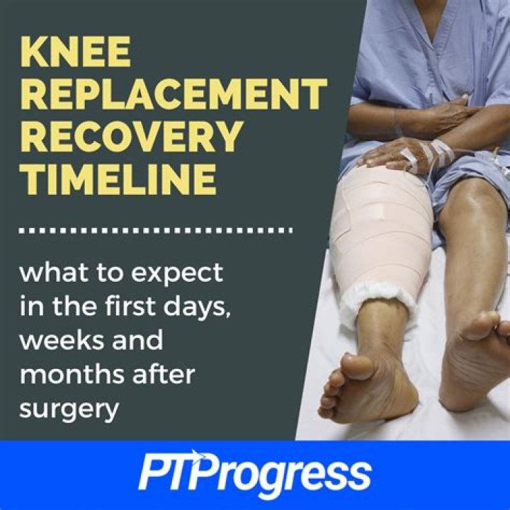 What happens one month after knee replacement?