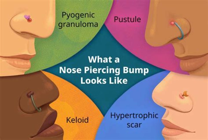 What hurts worse belly button or nose piercing?