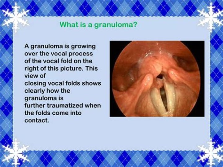 What is a rare granuloma?