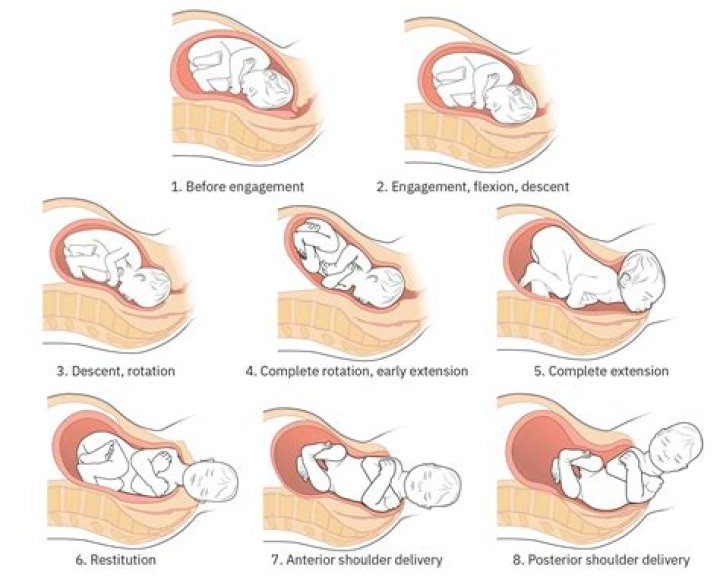 What is a restitution period?