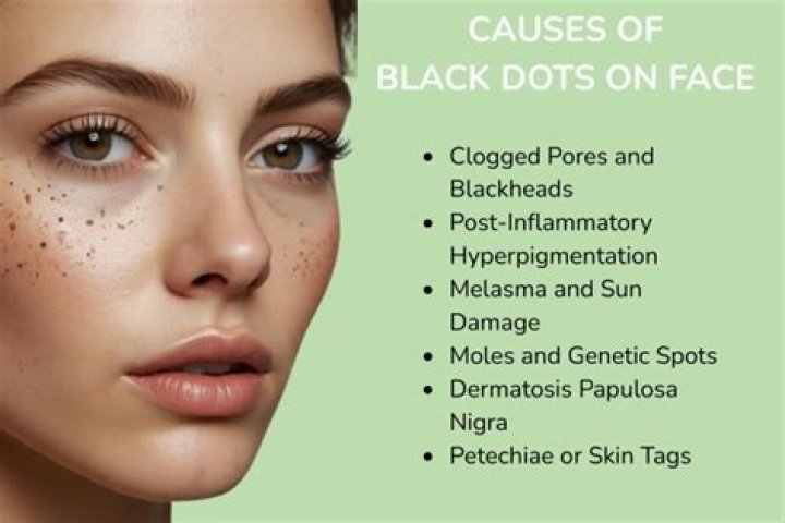 What is black dots on face?