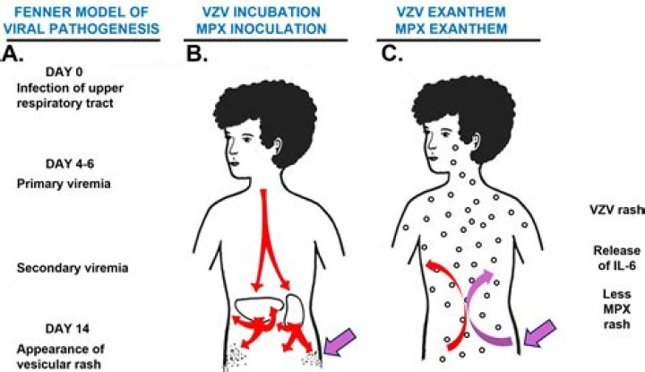 What is the incubation period for trichinosis?