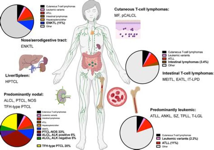 What is the survival rate of T-cell lymphoma?