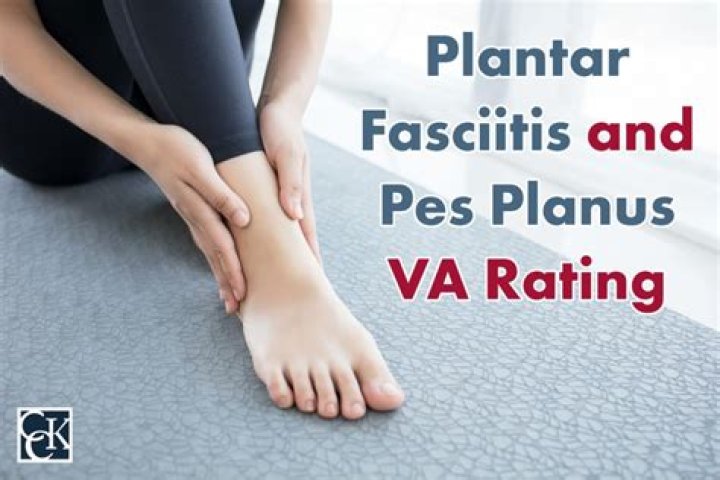 What is the VA disability rating for plantar fasciitis?