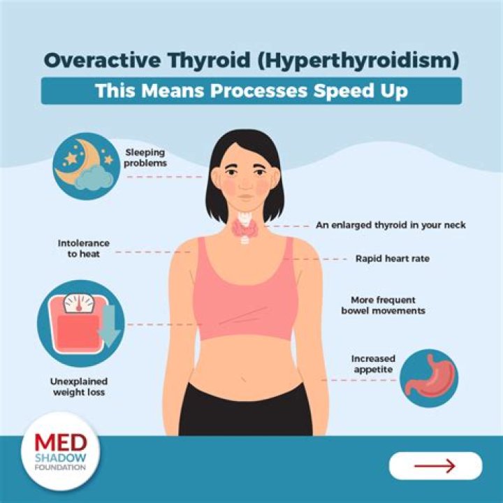 What lifestyle causes thyroid?