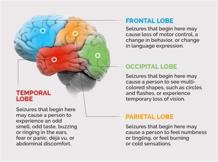 What part of the brain is affected by epilepsy?