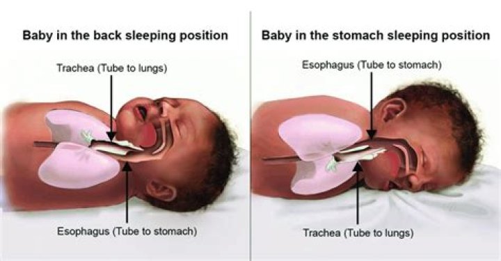 What position helps a baby with gas?