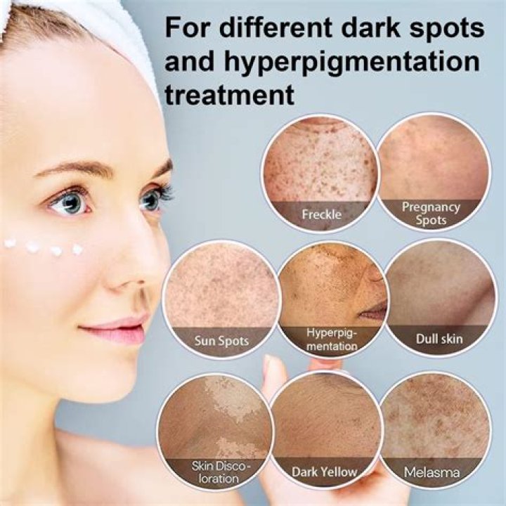 What product can remove pigmentation?