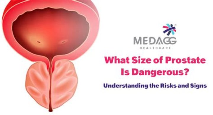 What size prostate lesions are cancerous?