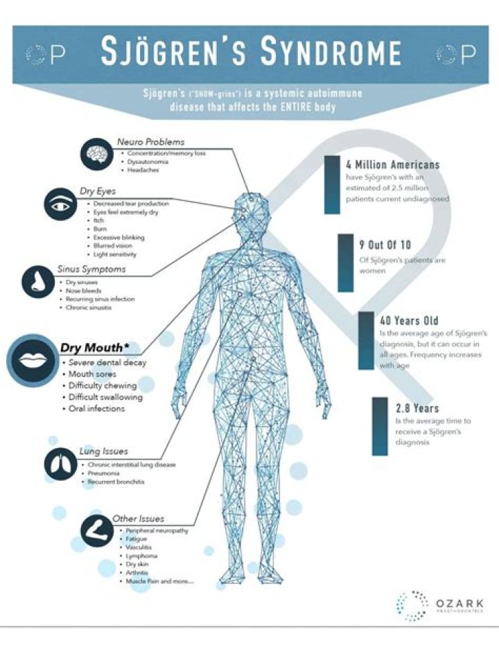 What type of doctor can diagnose Sjogren's syndrome?