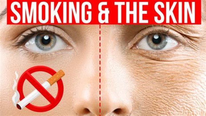 When does skin look better after quitting smoking?