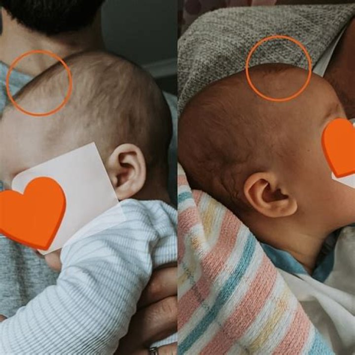 When should I be concerned about my baby's eyes?