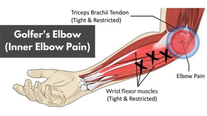 Where should elbows be when putting?