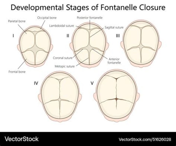 Which last longer closure or frontal?