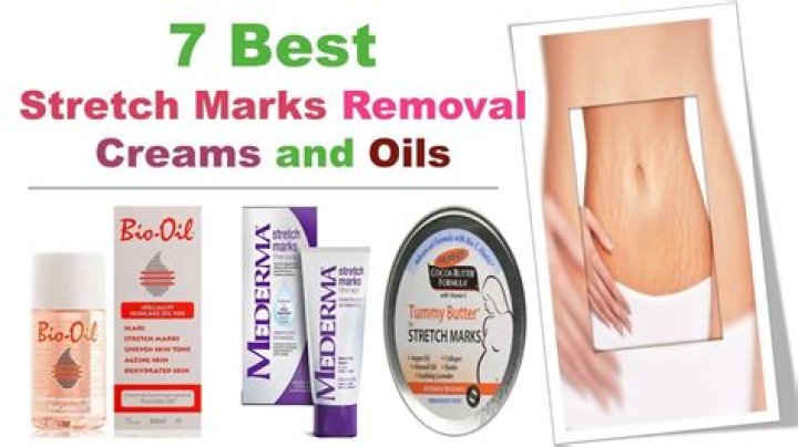 Which oil is best for stretch marks?