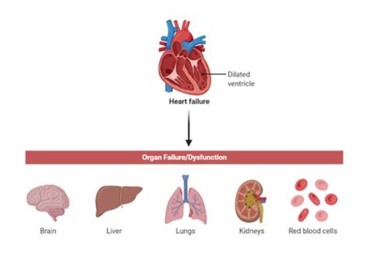 Which organ failure leads to death?
