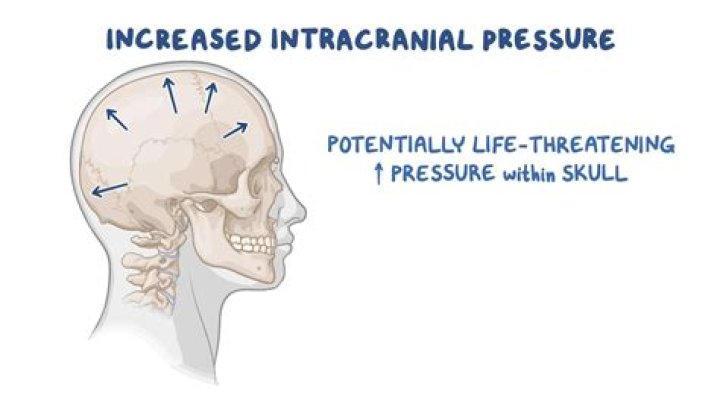 Which pressure will be increased if there is a haemorrhage inside the skull?