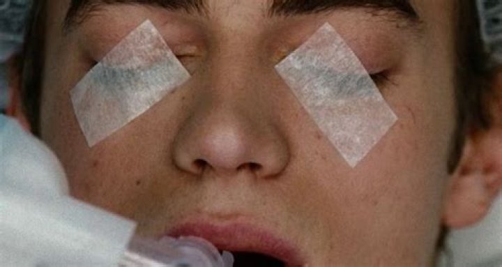 Why are eyes taped shut during surgery?
