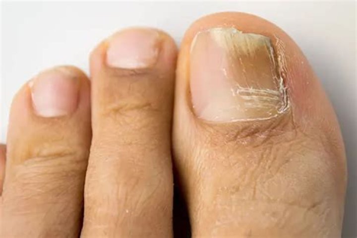 Why are my toenails Brown?