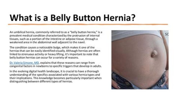 Why do I have a crease at my belly button?