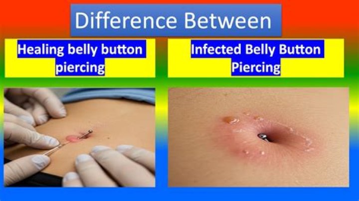 Why do I have to pee when I touch my belly button?