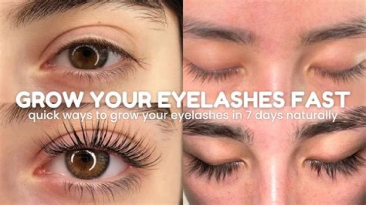 Why do my eyelashes itch and fall out?