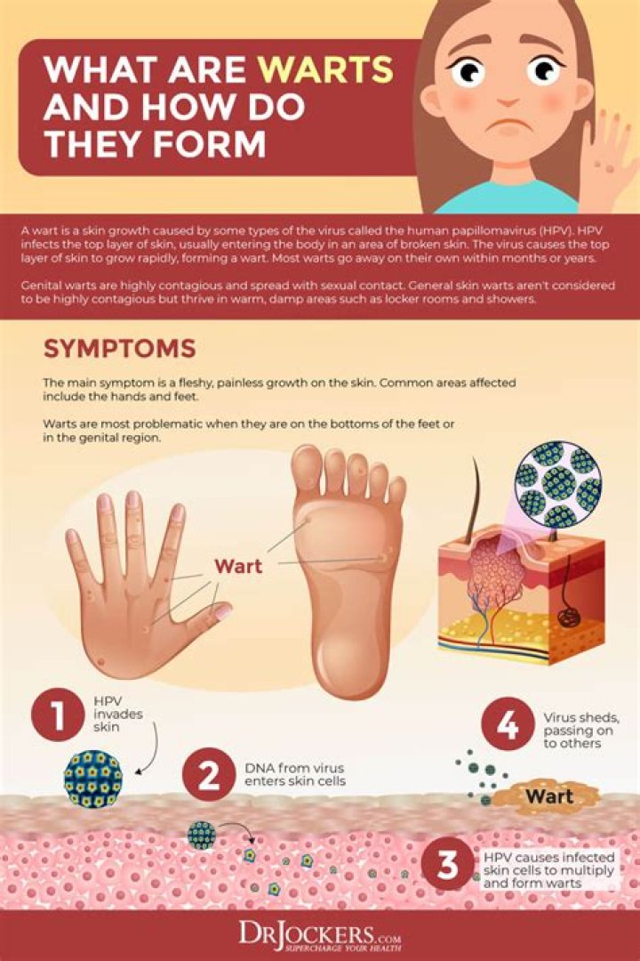 Why do warts form on fingers?