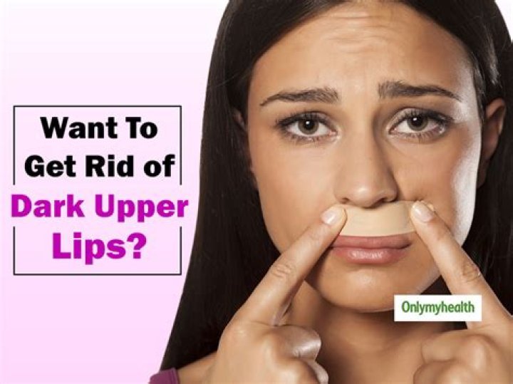 Why is my upper lip black?