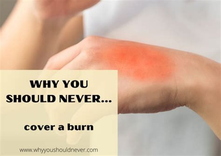 Why should you cover a burn after cooling it?